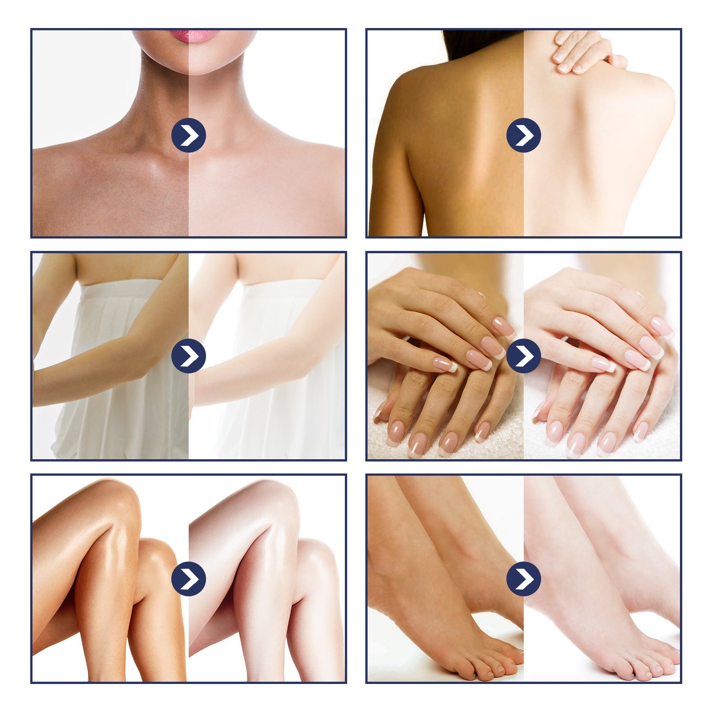 Underarm Whitening Cream Repair Knee Knuckle Elbow Underarm Melanin Moisturizing Skin